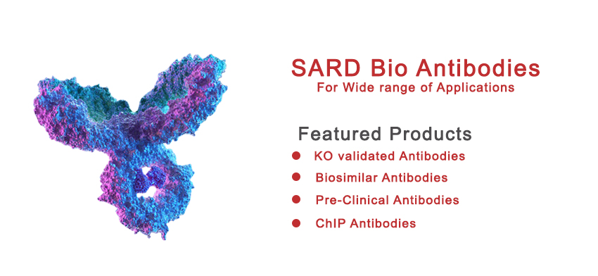 850 x 392_Antibody Home Banner_white